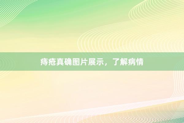 痔疮真确图片展示，了解病情